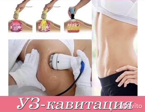 Кавитация