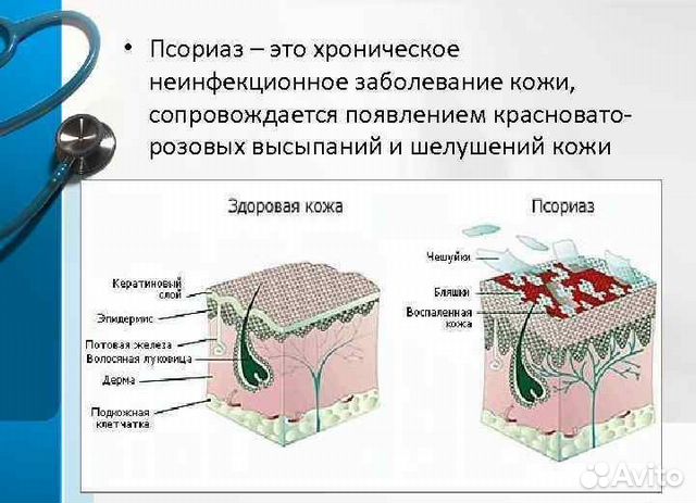 Доброволец в медицинских испытаниях по псориазу