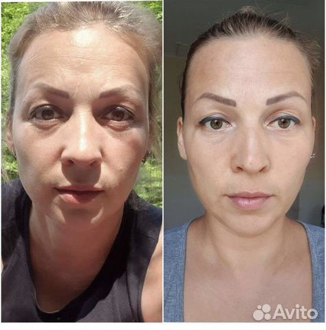 Скульптурно-моделирующий массаж лица