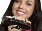 Готовый бизнес отбеливание зубов + установка скайс объявление продам