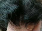 Система замещения волос(парик) объявление продам