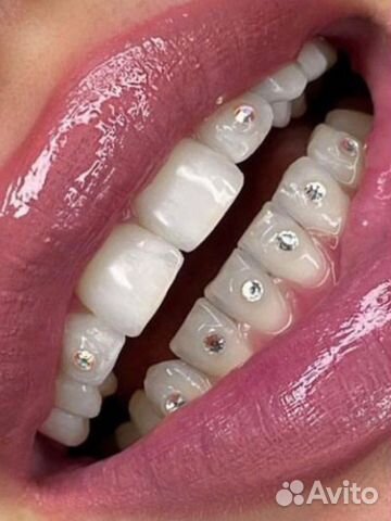 Установка Скайсов