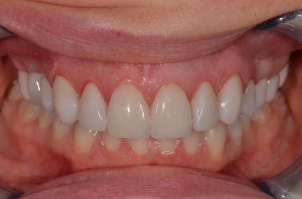 Зубной техник